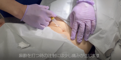 麻酔を打つ.png