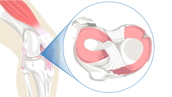 knees_2403_02.jpg