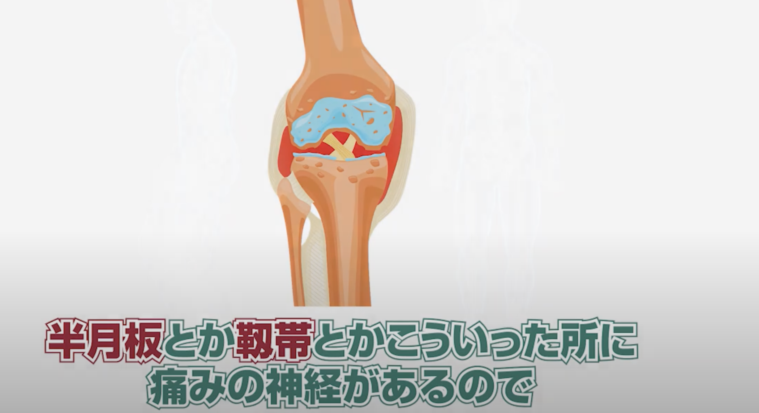 半月板や靭帯に痛み.png