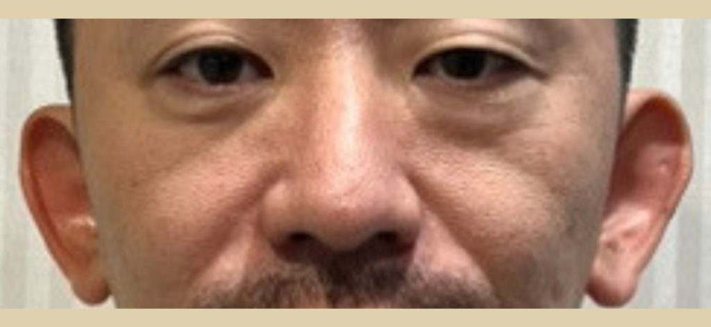 ゴルゴラインイメージ