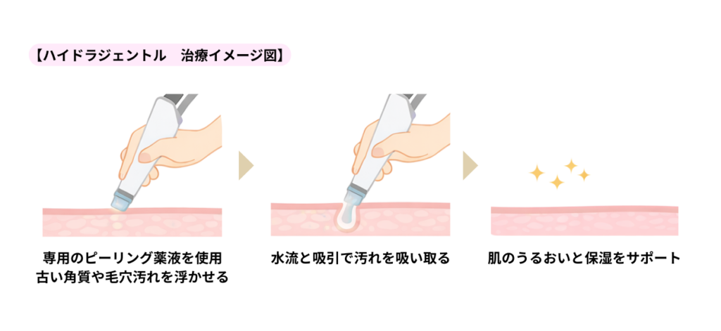 ハイドラジェントルのイメージ