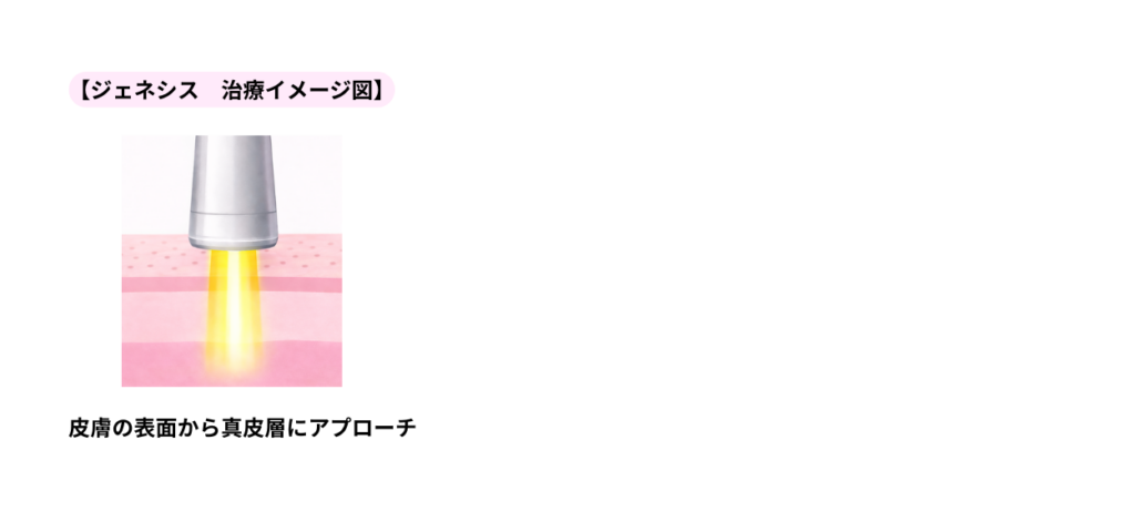 ジェネシスのイメージ