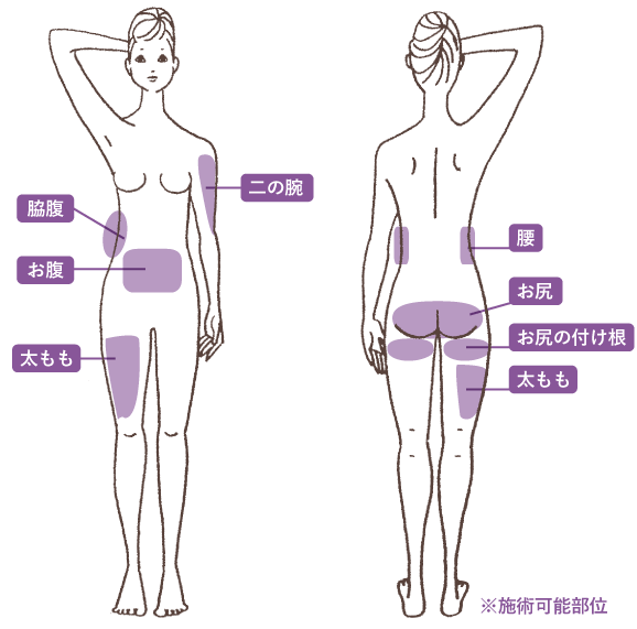 施術可能部位