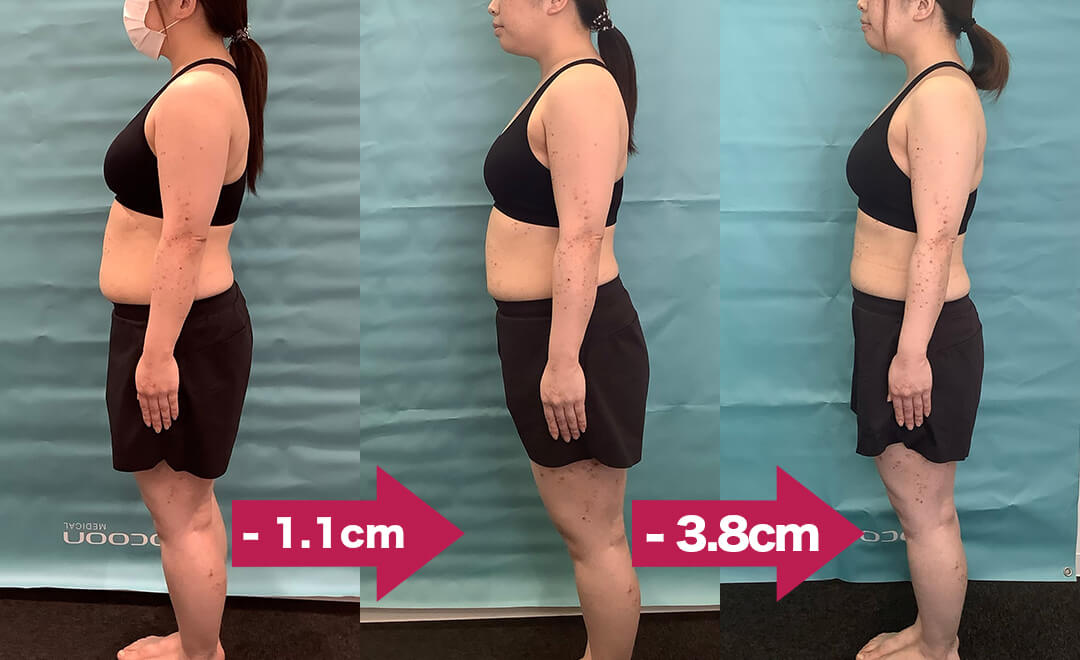 ビフォーアフター アヴェニュークリニック